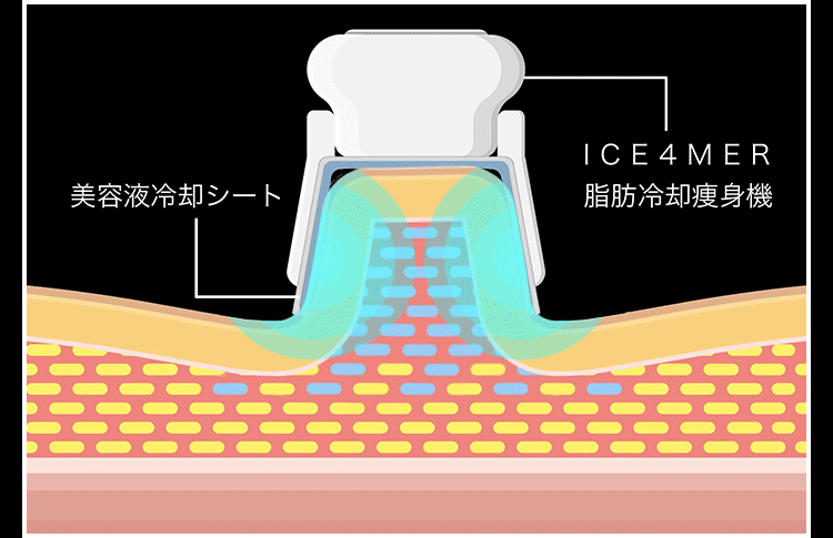 冷却システムの図