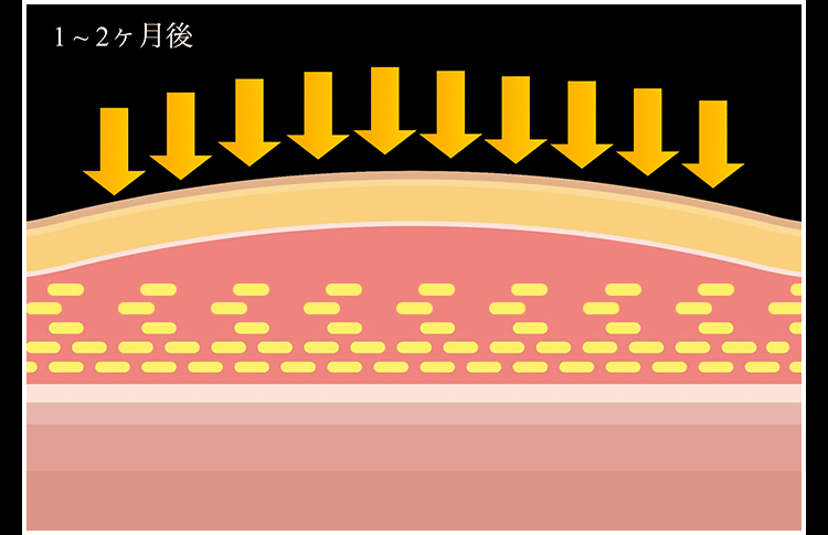 脂肪細胞の図